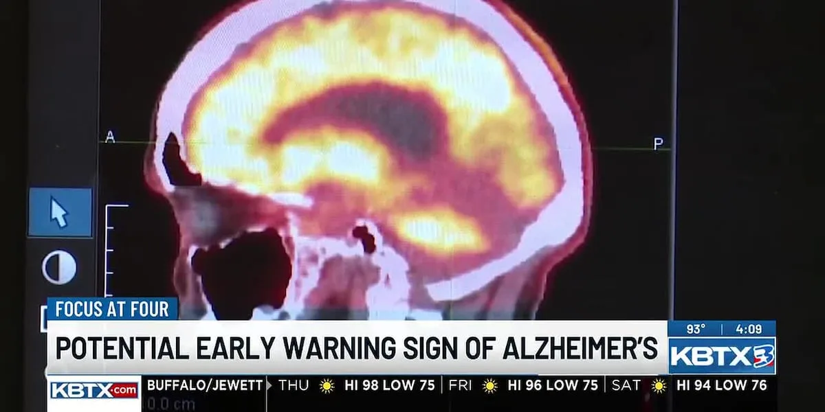 Texas A&M research finds earlier Alzheimer's warning sign