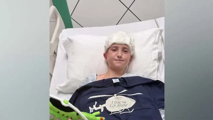 Teen survives traumatic brain injury after e-scooter crash, urges others to wear helmets